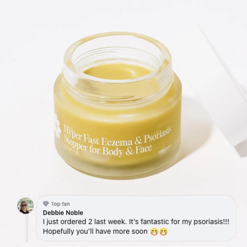 Frøya Organics Ultra-Fast Relief Balm for Dry, Itchy Skin – For Body & Face